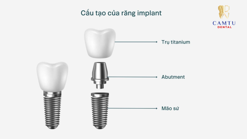 Thiết kế bề mặt và hình dạng trụ Implant