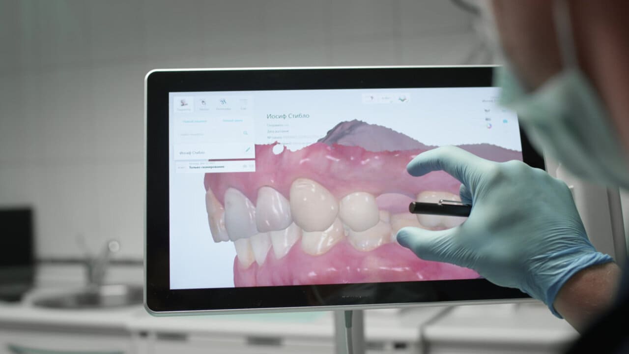 Công nghệ thiết kế nụ cười an toàn và chính xác