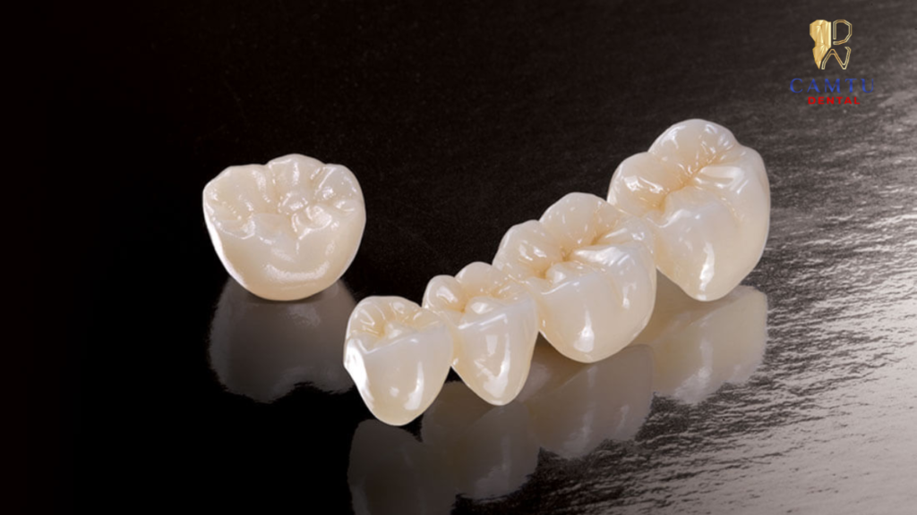 Ưu tiên những loại răng sứ bền, cao cấp và ít gây hại