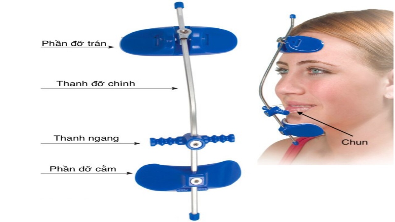 Cấu tạo khí cụ headgear