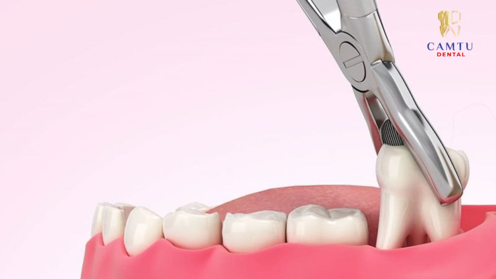 Máu chảy liên tục và không có dấu hiệu ngừng nghỉ