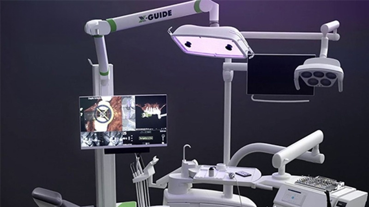 Công nghệ định vị cấy ghép implant bằng robot định vị X Guide là gì?