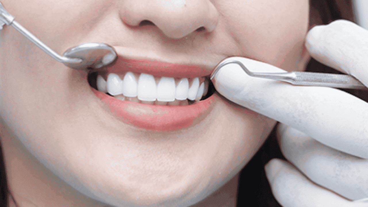 Lợi ích khi sử dụng công nghệ thiết kế nụ cười 