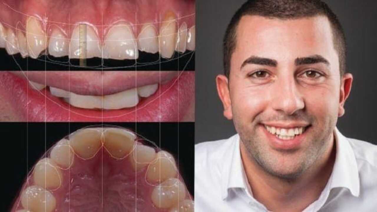 Smile Digital Design thu thập dữ liệu khuôn mặt