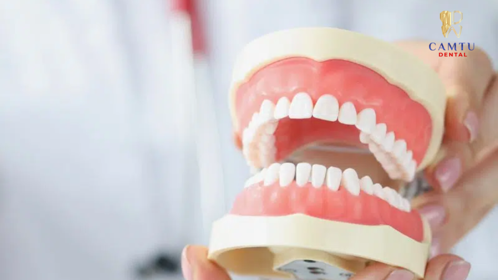 Răng cửa phải che phủ 1 phần 2 đến 1 phần 3 răng dưới