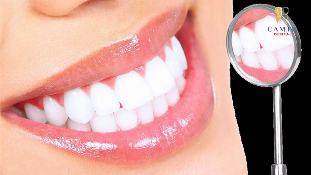 Tự ý tẩy trắng răng tại nhà là một trong những nguyên nhân chính