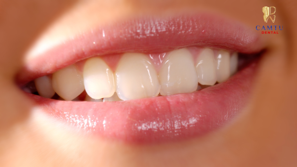 Để có hàm răng trắng đẹp thì bạn nên thăm khám và lựa chọn cơ sở uy tín