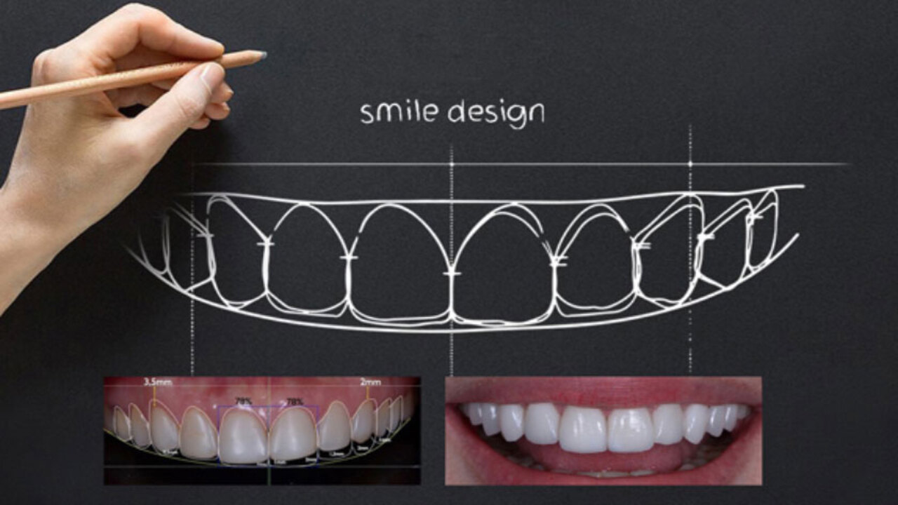 Sở hữu nụ cười đẹp với kế hoạch điều trị bài bản