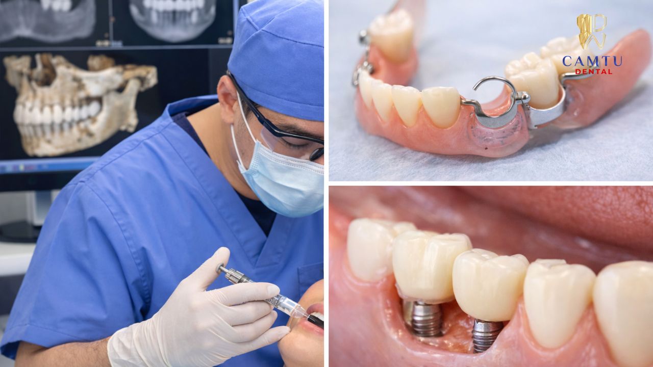 Phương pháp phục hình truyền thống