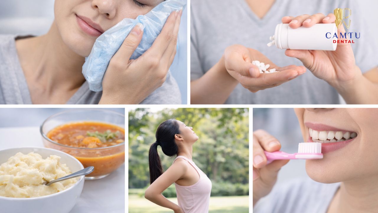 Chăm sóc răng sau phẫu thuật cấy ghép