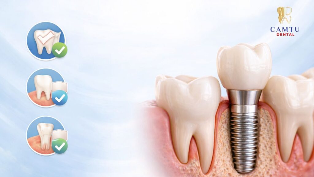 mất 1 răng có nên trồng implant