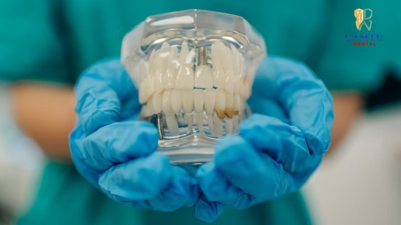 Implant tái tạo cả chân răng và thân răng
