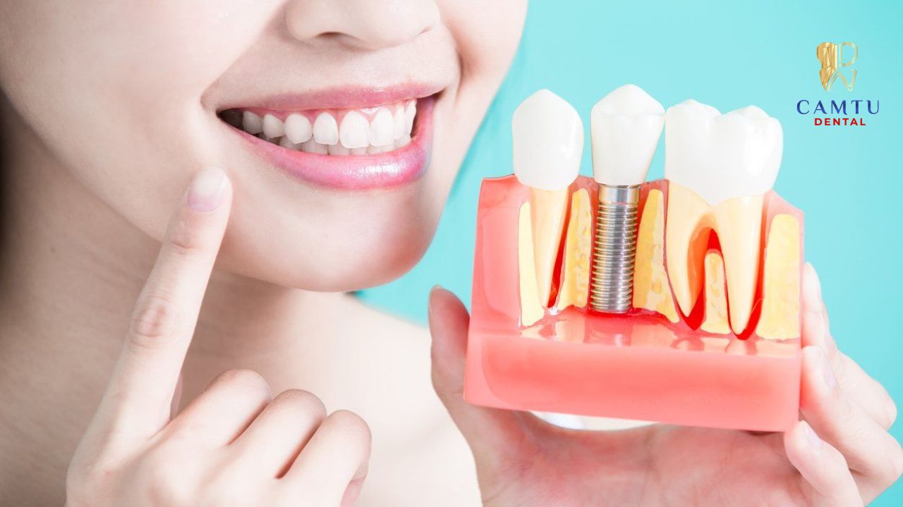 Thực hiện đúng theo yêu cầu của Bác sẽ giúp Implant lành nhanh hơn
