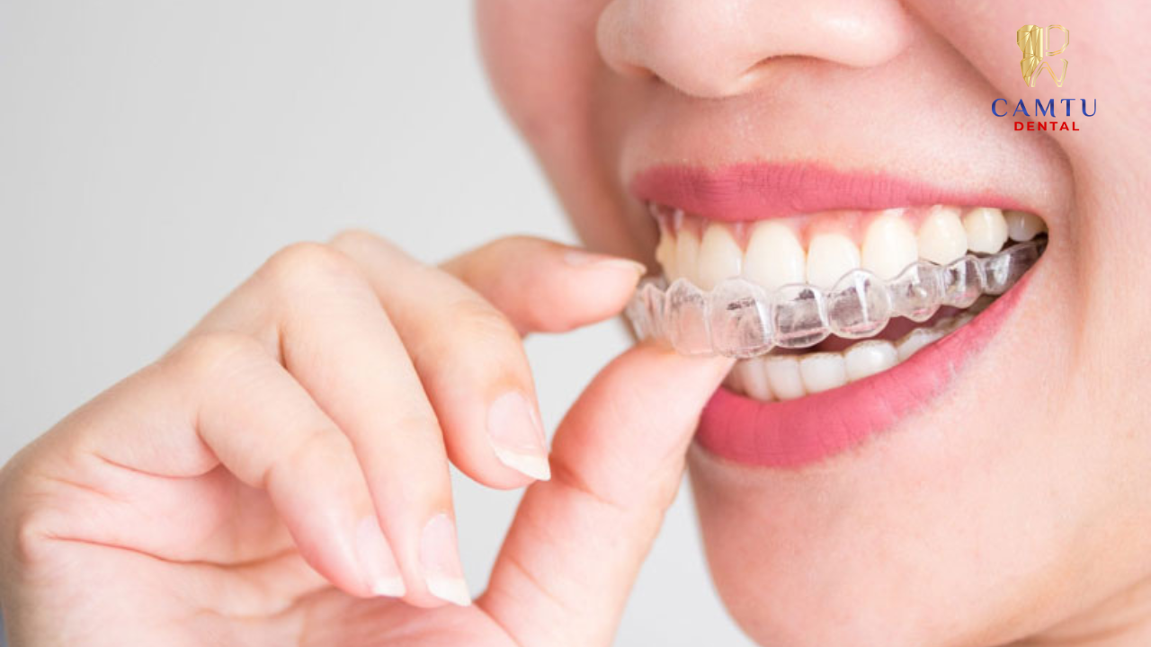 Khay niềng trong suốt mang lại tính thẩm mỹ cao và dễ tháo lắp khi sử dụng