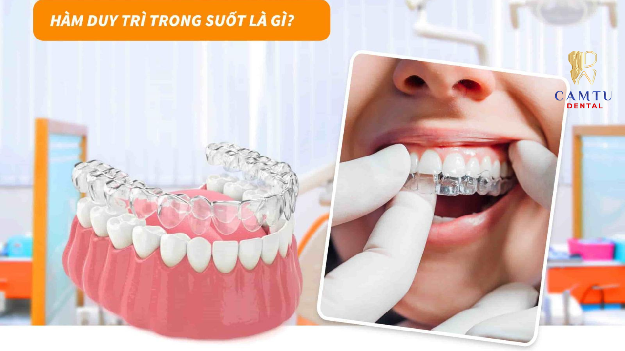 Hàm duy trì trong suốt thẩm mỹ cao, ôm sát răng và dễ tháo lắp