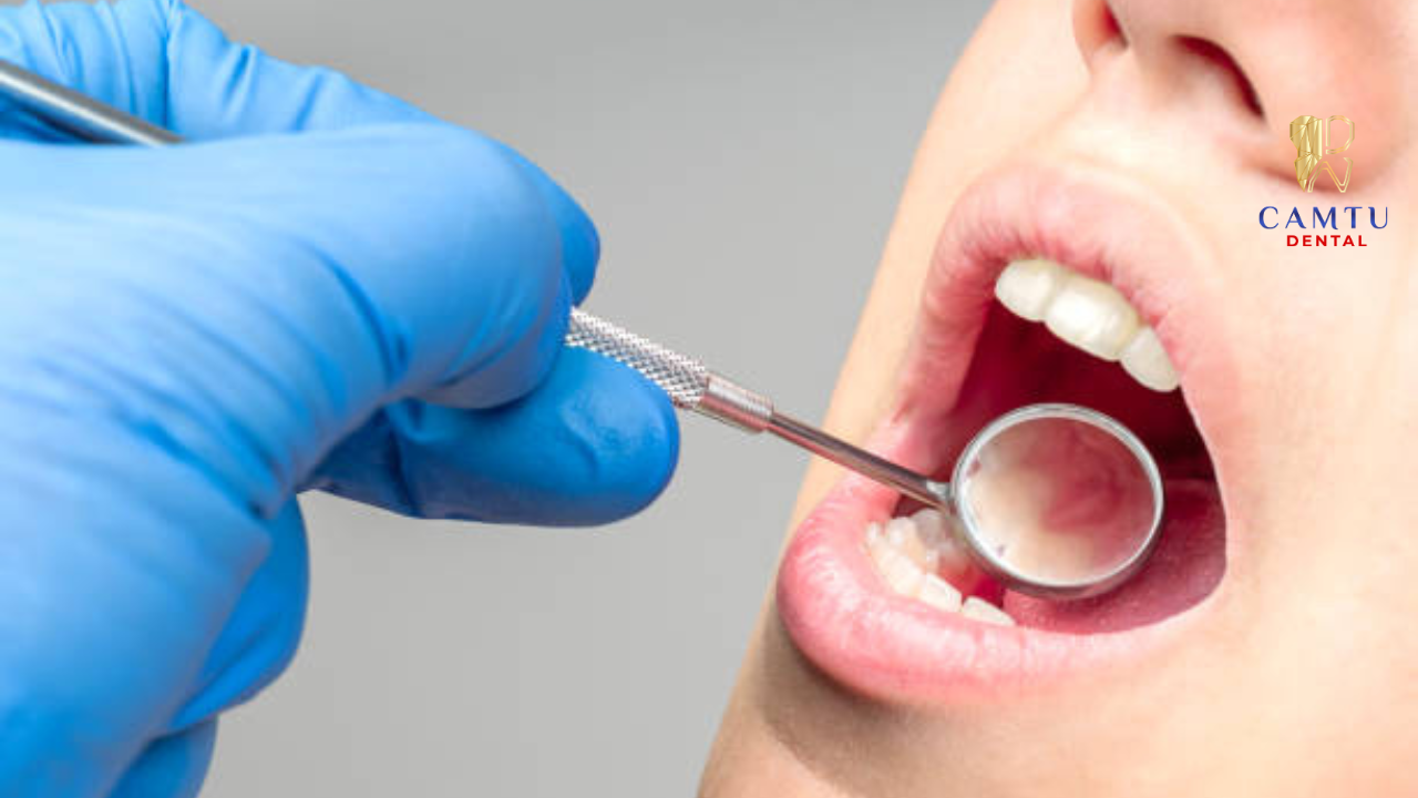 Nhận biết dấu hiệu bất thường để xử lý kịp thời sau khi gắn mắc cài