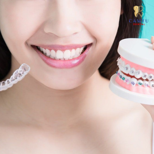 Người lớn có niềng răng được không