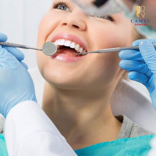 Sau khi niềng răng cần làm gì