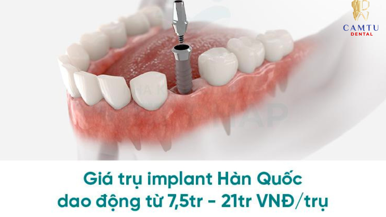 Tối ưu ngân sách, đúng chuẩn phục hình