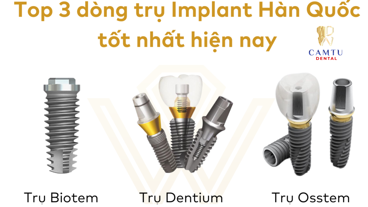 Nên chọn Implant Hàn Quốc loại nào tốt nhất cho bạn