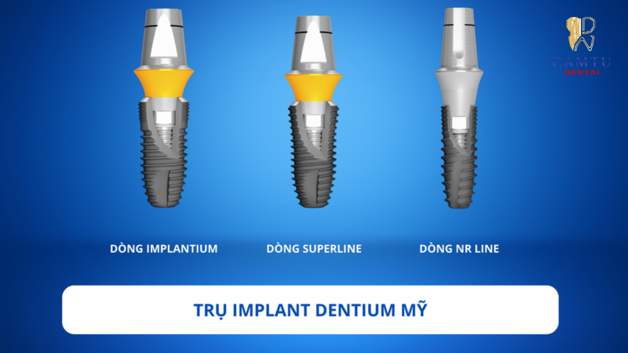 Bí quyết chọn đúng loại Implant Mỹ phù hợp nhất