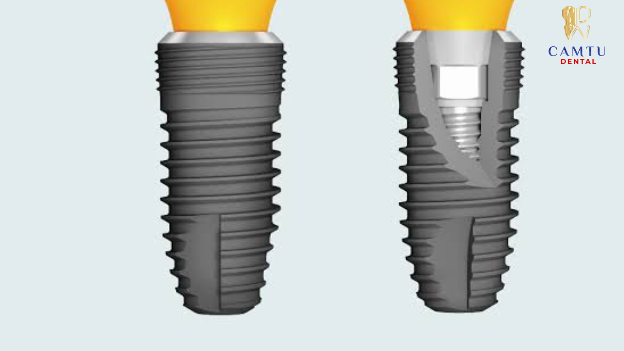 Dentium USA SuperLine – Titanium tinh khiết, tích hợp tối ưu