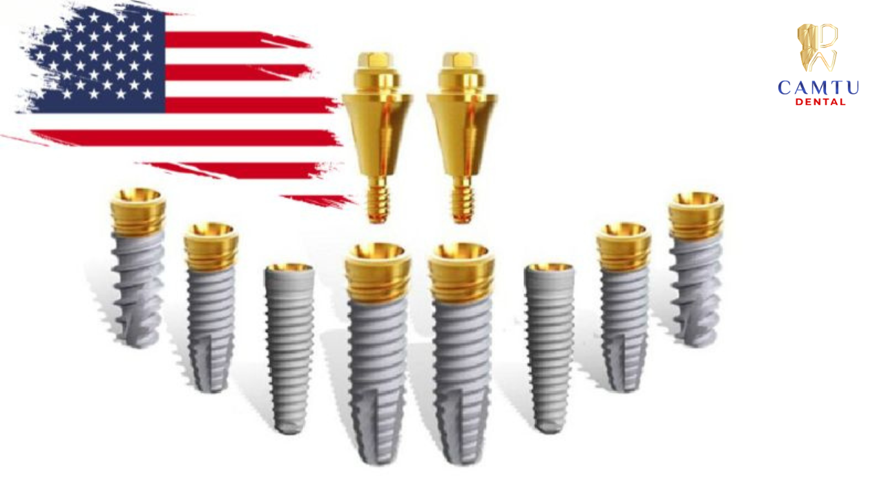 Implant Mỹ – Đỉnh cao phục hình răng mất